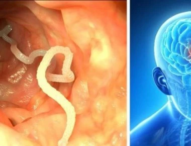 Κάτι που τρώμε όλοι μπορεί να δημιουργήσει παράσιτα στον εγκέφαλο (φωτό)